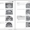 Gehl Compact Track Loader CTL65 Service Manual 917337C 08 2